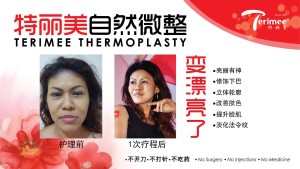 Thermoplasty Model PG1  (9)